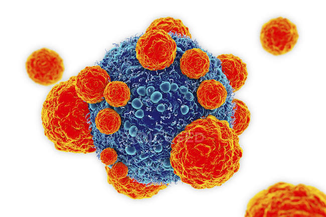 cancer cells